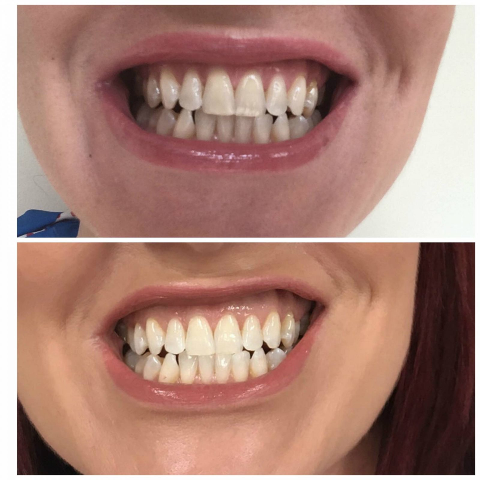 Affordable Teeth Whitening For Coffee Addicts + Giveaway